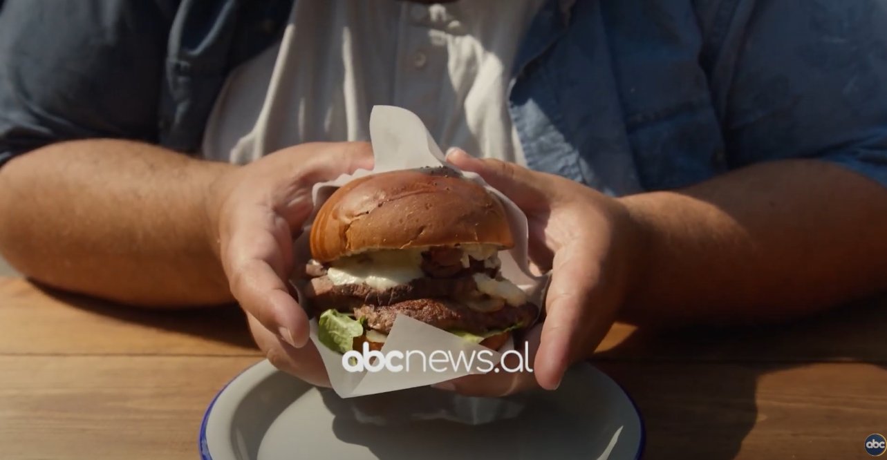 Obeziteti te fëmijët: Rreziqet shëndetësore dhe komplikimet