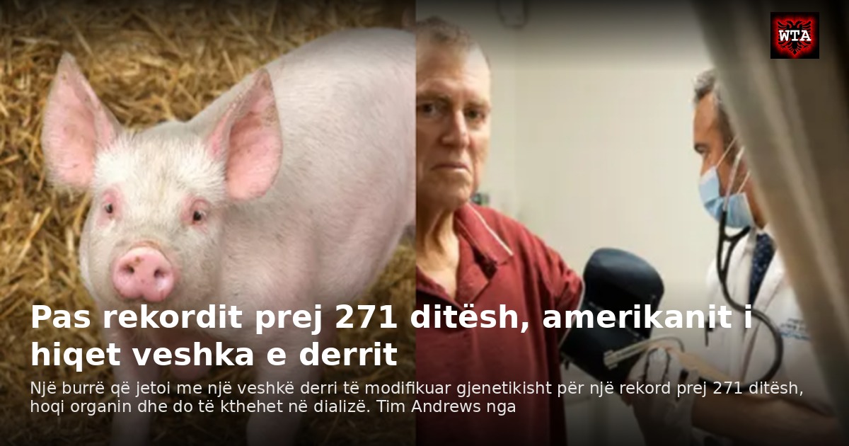 Pas rekordit prej 271 ditësh, amerikanit i hiqet veshka e derrit