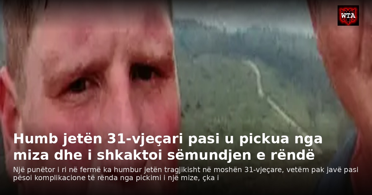 Humb jetën 31-vjeçari pasi u pickua nga miza dhe i shkaktoi sëmundjen e rëndë
