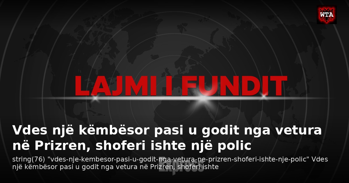 Vdes një këmbësor pasi u godit nga vetura në Prizren, shoferi ishte një polic