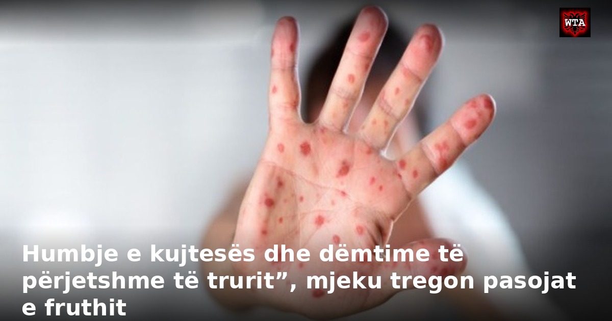 Humbje e kujtesës dhe dëmtime të përjetshme të trurit”, mjeku tregon pasojat e fruthit