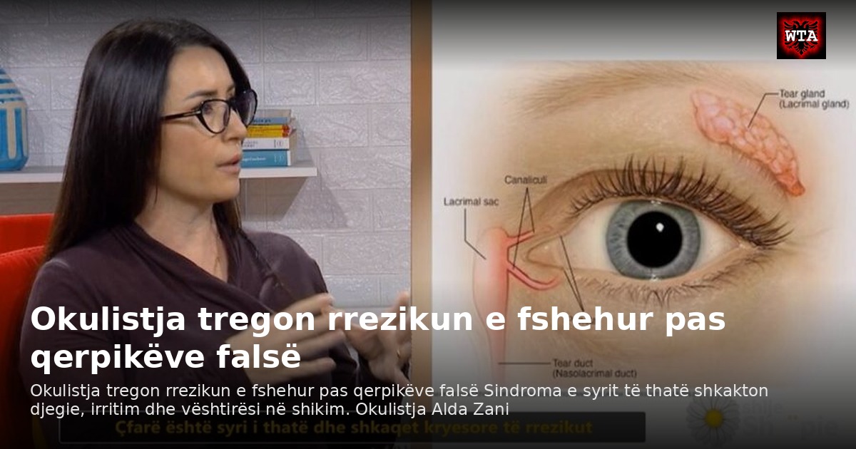 Okulistja tregon rrezikun e fshehur pas qerpikëve falsë