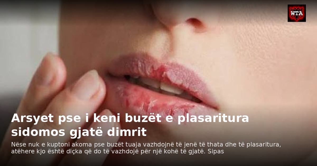 Arsyet pse i keni buzët e plasaritura sidomos gjatë dimrit