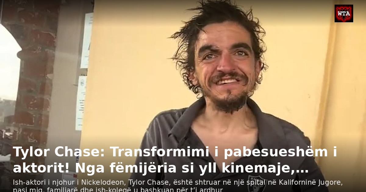 Tylor Chase: Transformimi i pabesueshëm i aktorit! Nga fëmijëria si yll kinemaje,…