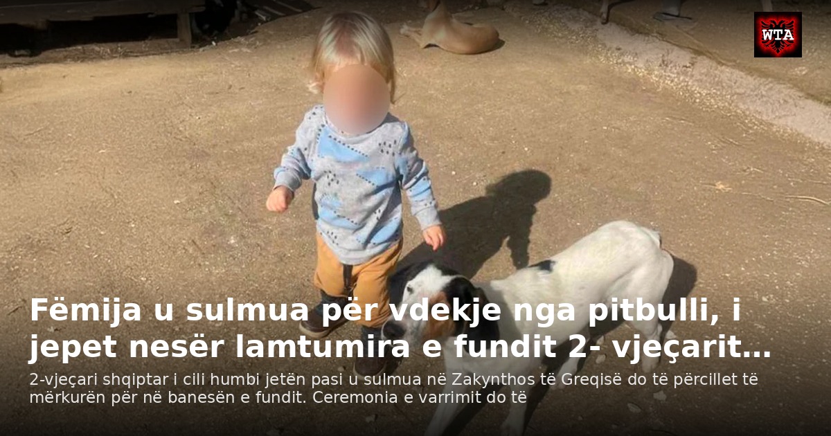 Fëmija u sulmua për vdekje nga pitbulli, i jepet nesër lamtumira e fundit 2- vjeçarit…