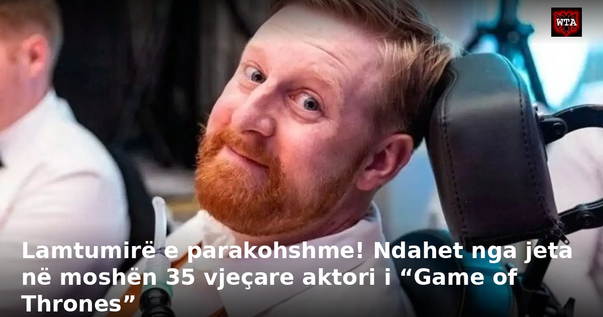 Lamtumirë e parakohshme! Ndahet nga jeta në moshën 35 vjeçare aktori i “Game of Thrones”