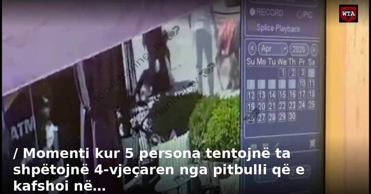 / Momenti kur 5 persona tentojnë ta shpëtojnë 4-vjeçaren nga pitbulli që e kafshoi në…