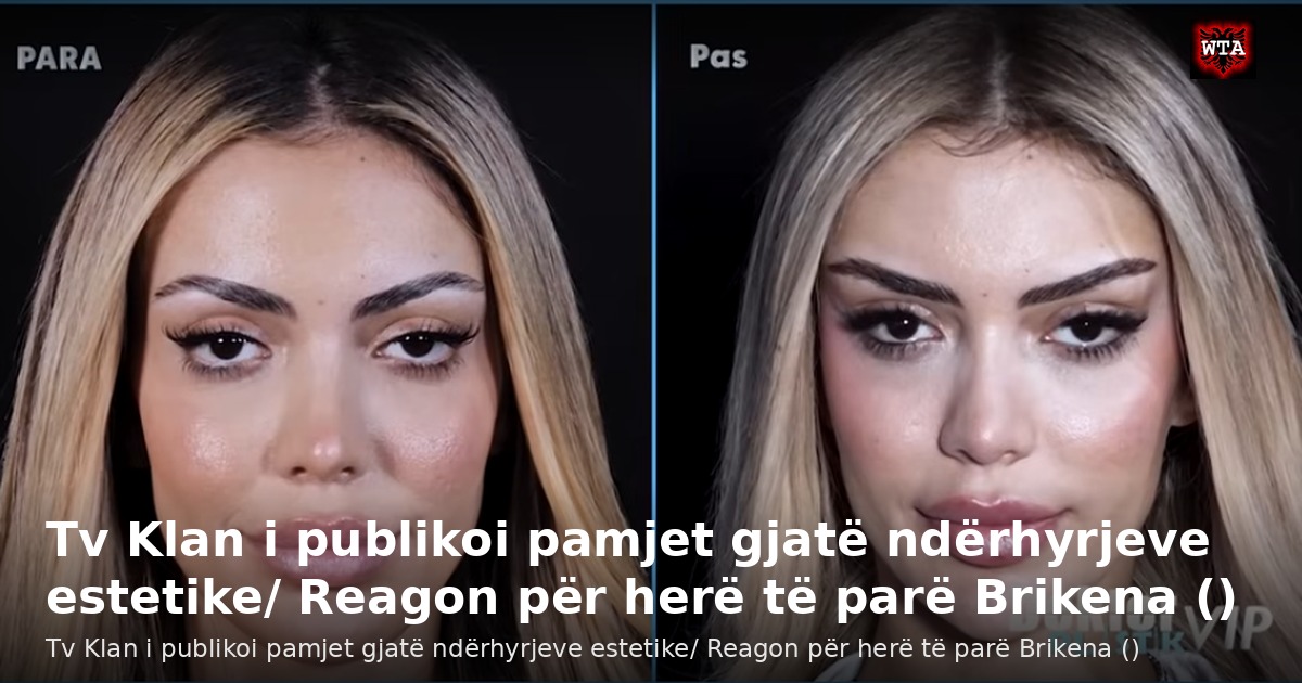 Tv Klan i publikoi pamjet gjatë ndërhyrjeve estetike/ Reagon për herë të parë Brikena ()