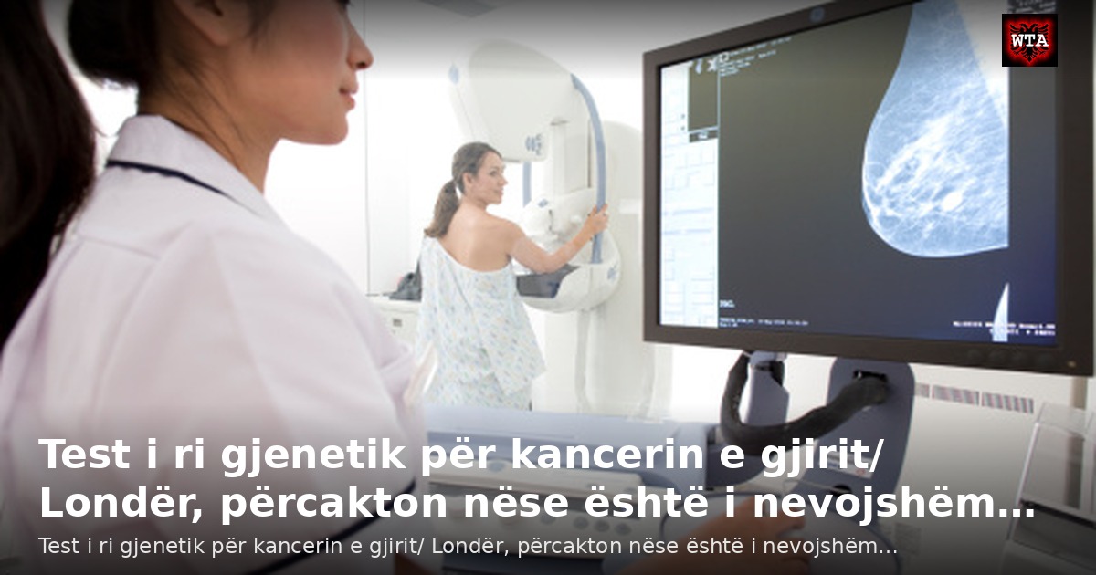 Test i ri gjenetik për kancerin e gjirit/ Londër, përcakton nëse është i nevojshëm…