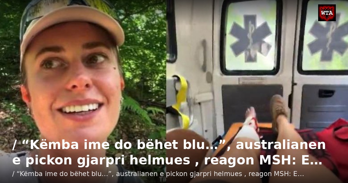 / “Këmba ime do bëhet blu…”, australianen e pickon gjarpri helmues , reagon MSH: E…