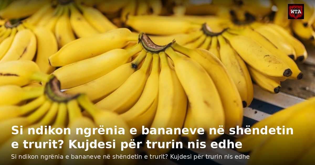 Si ndikon ngrënia e bananeve në shëndetin e trurit? Kujdesi për trurin nis edhe