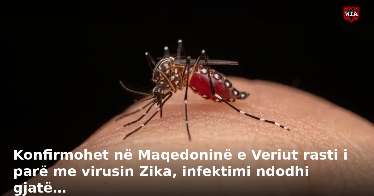 Konfirmohet në Maqedoninë e Veriut rasti i parë me virusin Zika, infektimi ndodhi gjatë…