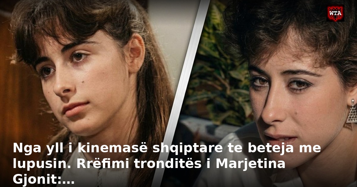 Nga yll i kinemasë shqiptare te beteja me lupusin. Rrëfimi tronditës i Marjetina Gjonit:…