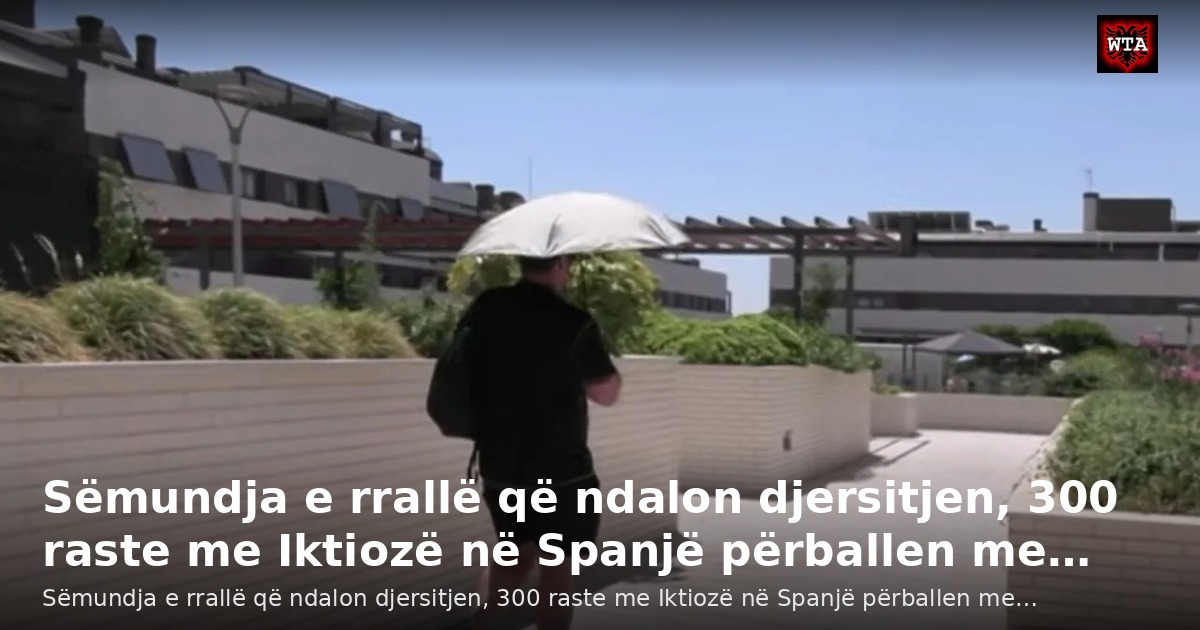 Sëmundja e rrallë që ndalon djersitjen, 300 raste me Iktiozë në Spanjë përballen me…