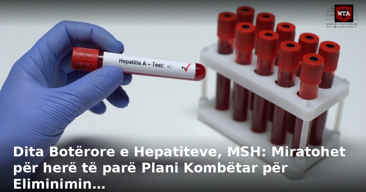 Dita Botërore e Hepatiteve, MSH: Miratohet për herë të parë Plani Kombëtar për Eliminimin…