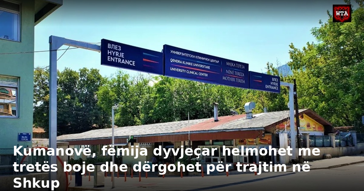 Kumanovë, fëmija dyvjeçar helmohet me tretës boje dhe dërgohet për trajtim në Shkup